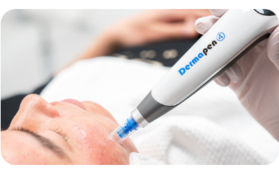 Imagem dermapen